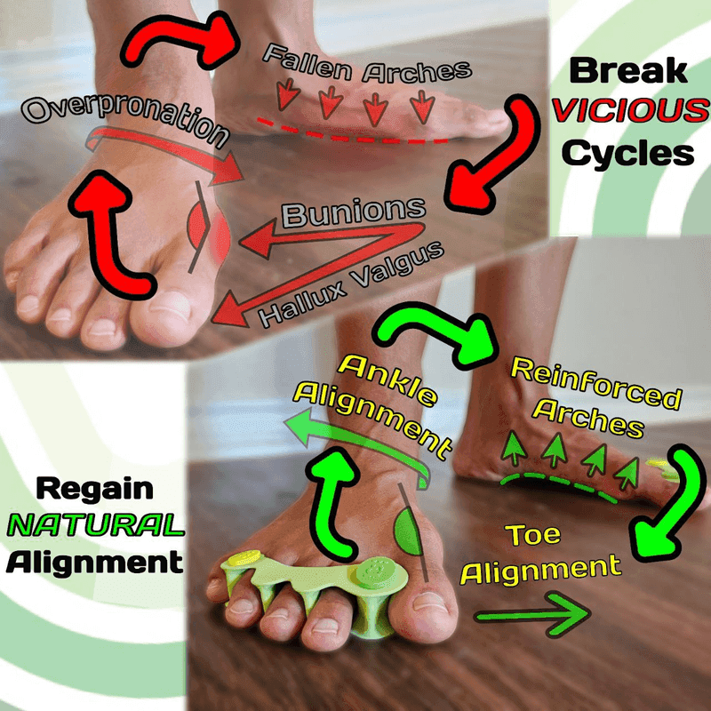 Toe Spreaders by Allways barefoot - Combat Bunions & Strengthen Arches gallery 4